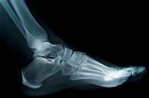 Online Podiatric Medical Radiological Technician Course